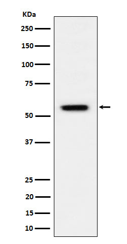 Anti-Phospho-Vimentin (Ser39) Rabbit Monoclonal Antibody