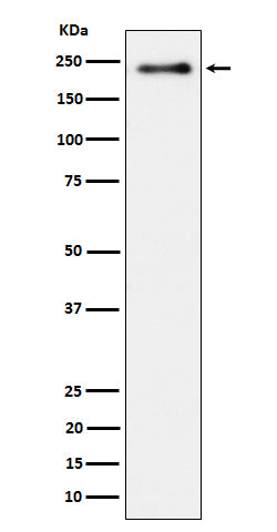 Anti-Phospho-LRP6 (Ser1490) Rabbit Monoclonal Antibody