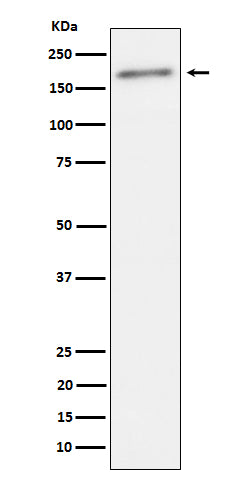 Anti-Phospho-ErbB 2(Tyr1221 /Tyr1222)  Rabbit Monoclonal Antibody