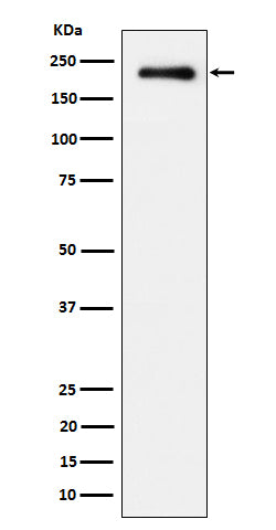Anti-Phospho-EGFR (Tyr845) Rabbit Monoclonal Antibody