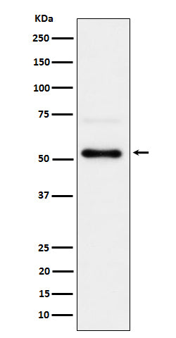 Anti-Phospho-Chk1 (Serer280) Rabbit Monoclonal Antibody