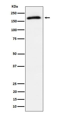 Anti-Phospho-AS160 (Thr642) Rabbit Monoclonal Antibody