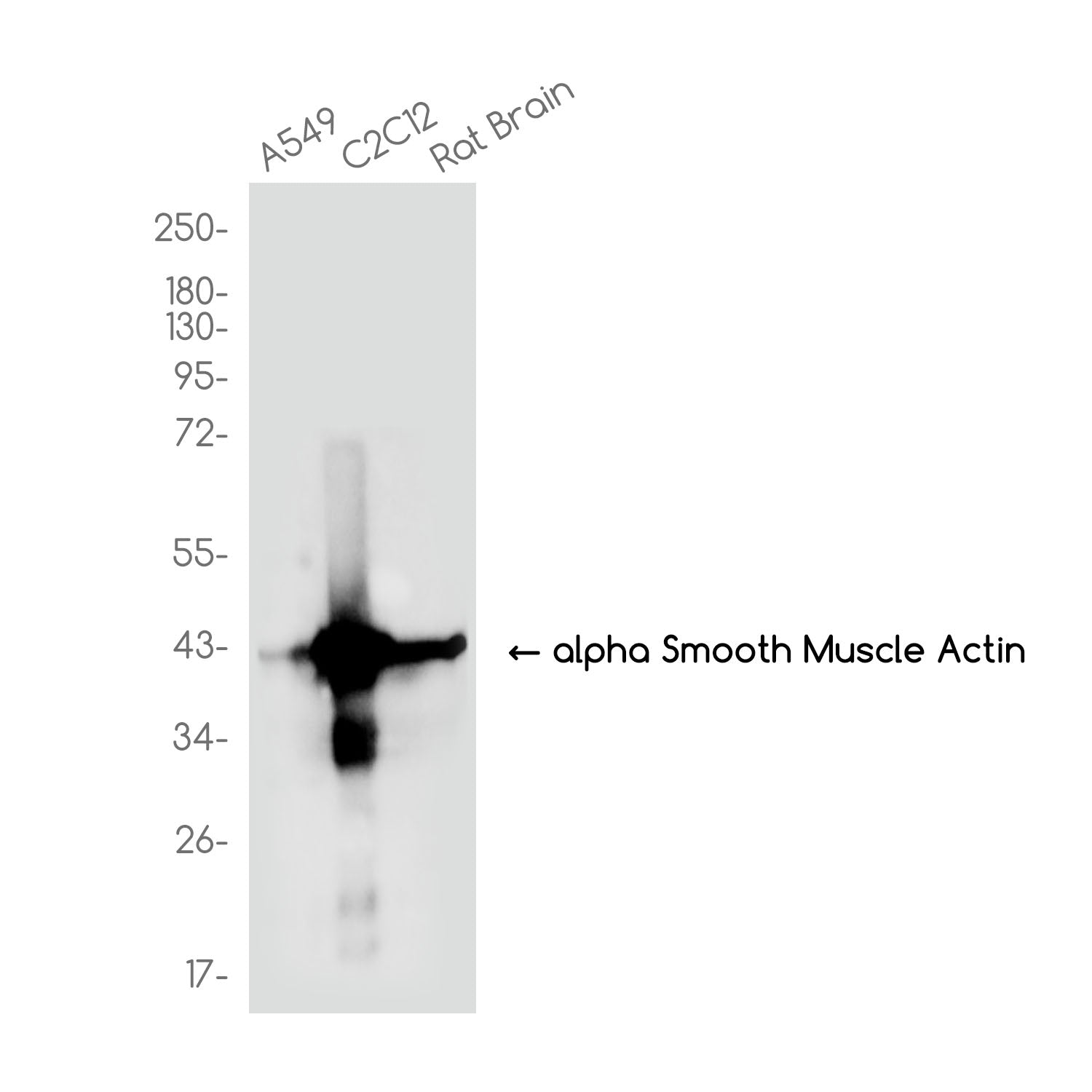 Anti-alpha Smooth Muscle Actin Rabbit Monoclonal Antibody