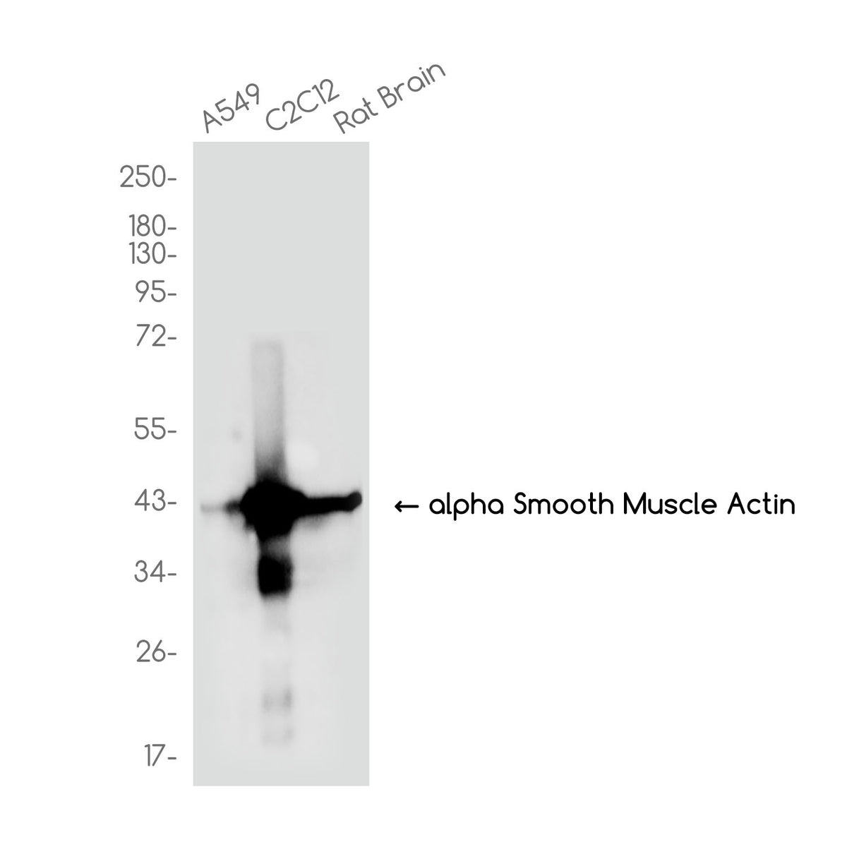 Anti-alpha Smooth Muscle Actin Rabbit Monoclonal Antibody