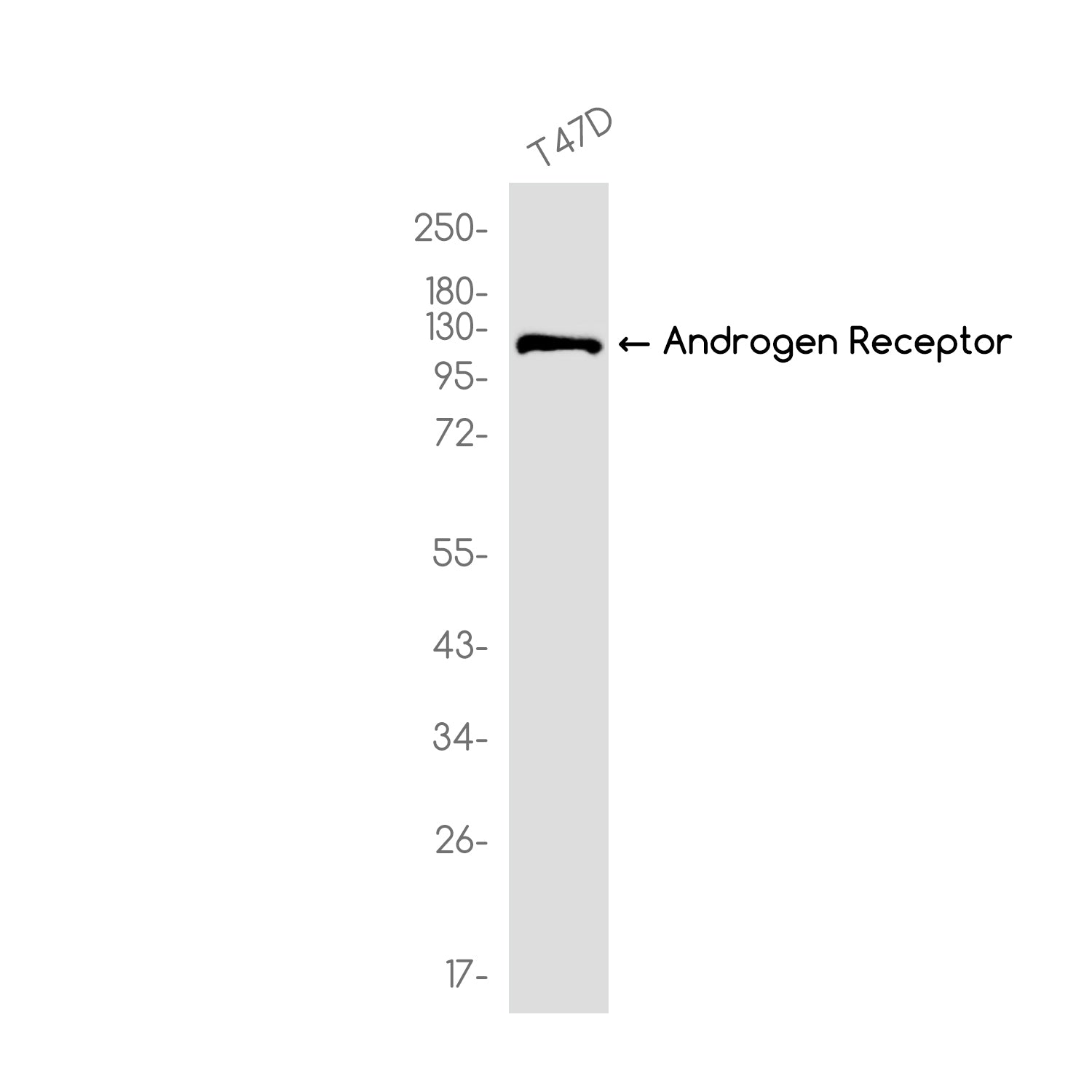 Anti-Androgen Receptor Rabbit Monoclonal Antibody
