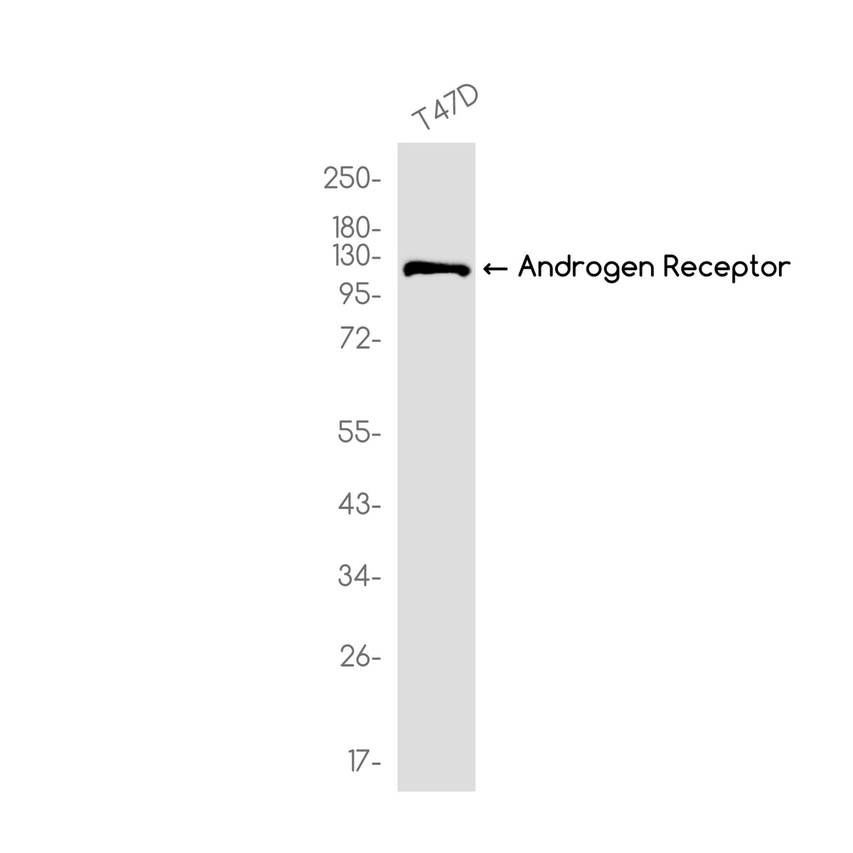 Anti-Androgen Receptor Rabbit Monoclonal Antibody