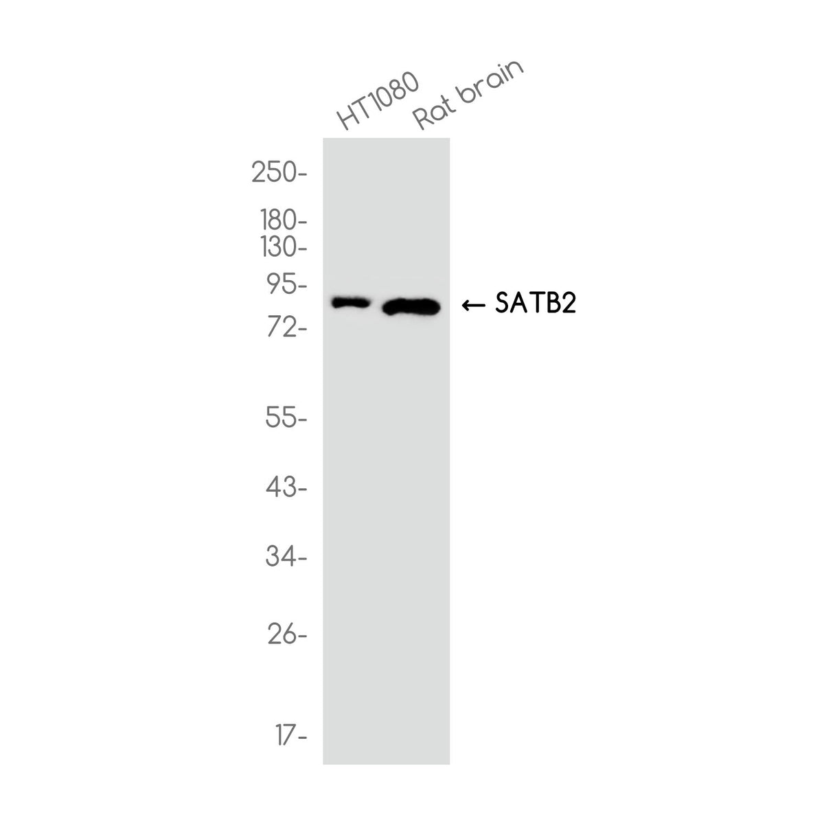 Anti-SATB2 Rabbit Monoclonal Antibody