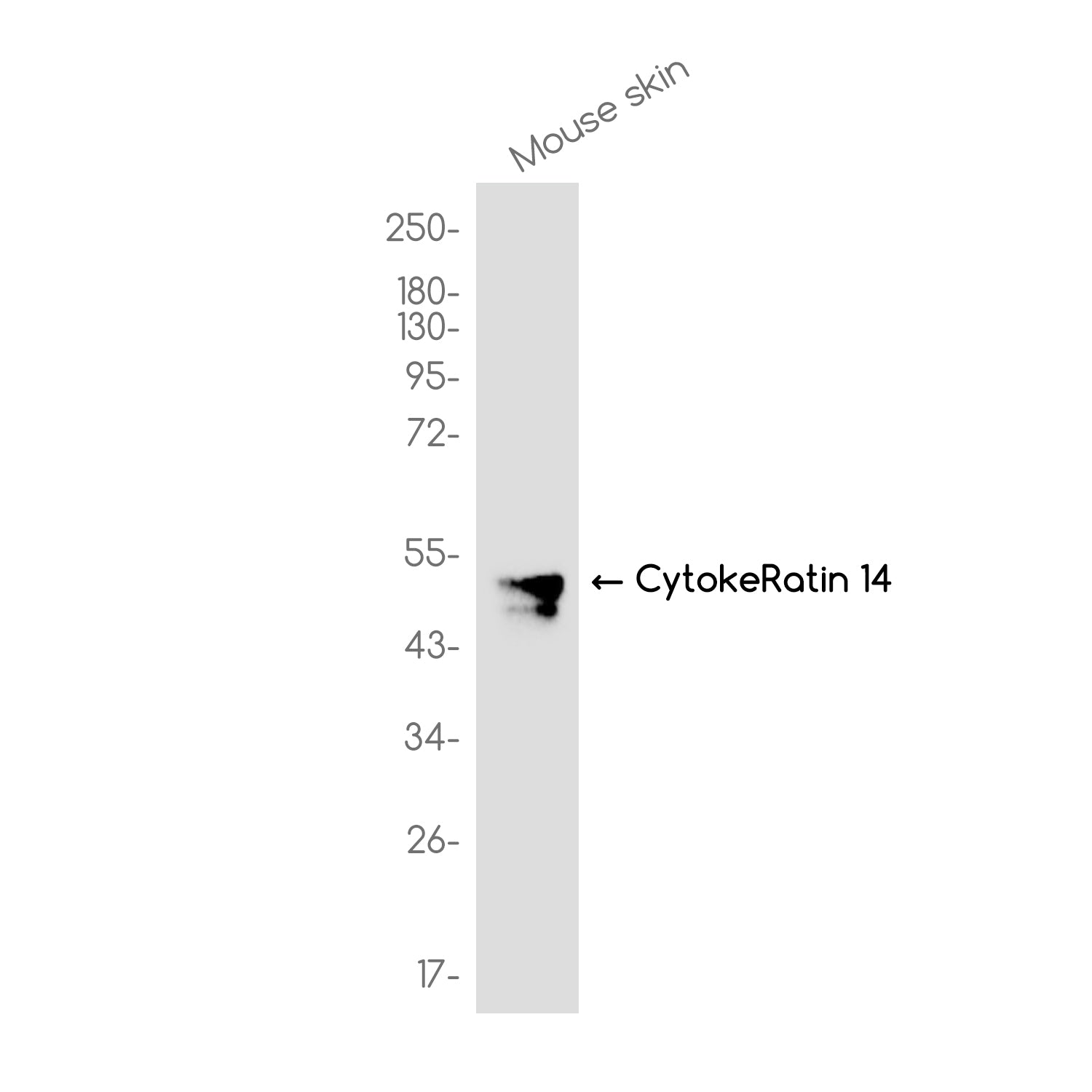Anti-Cytokeratin 14 Rabbit Monoclonal Antibody