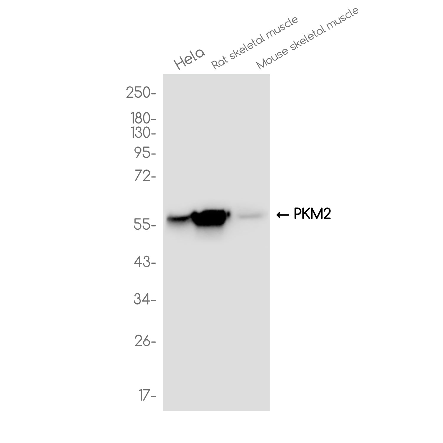 Anti-PKM2 Rabbit Monoclonal Antibody