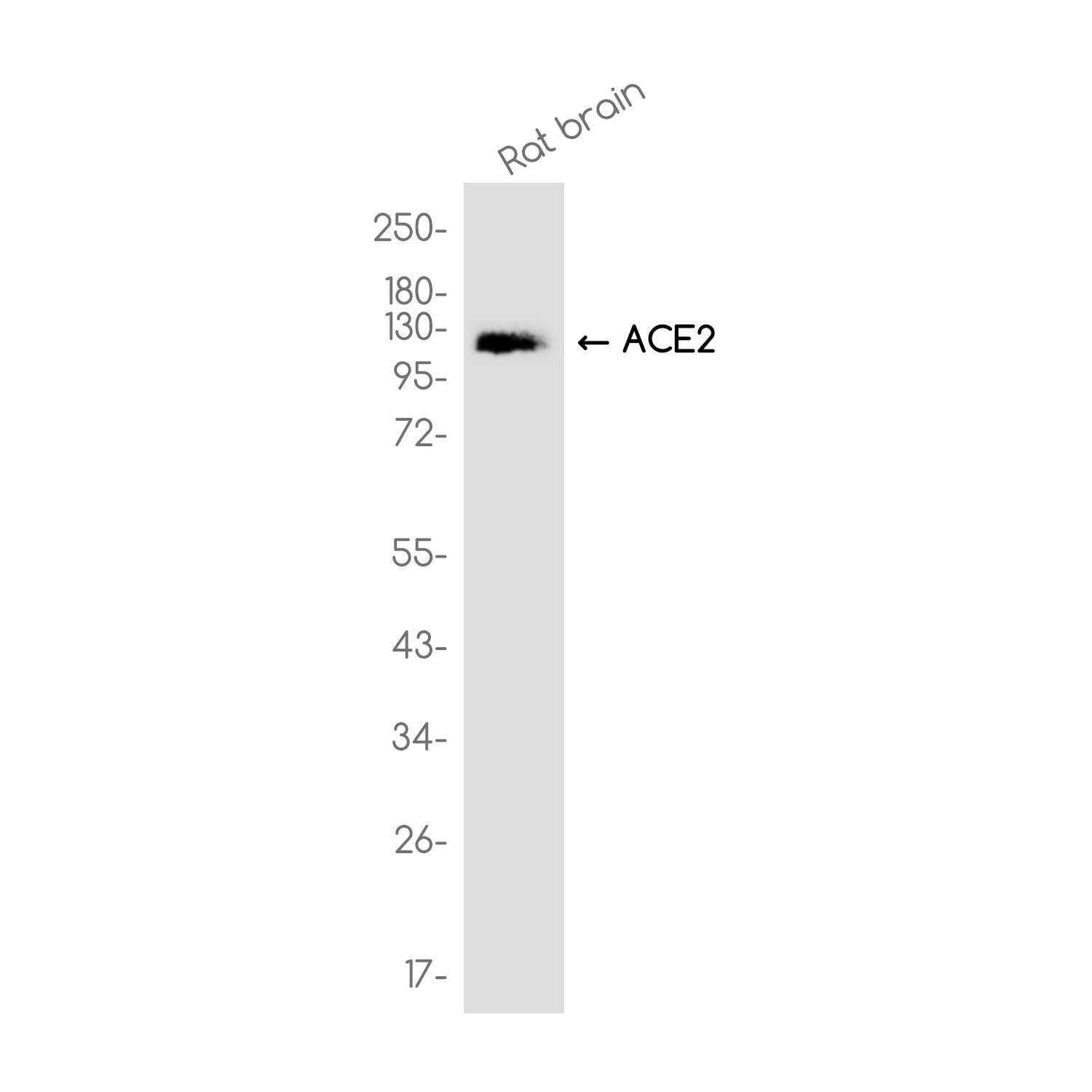 Anti-ACE2 Rabbit Monoclonal Antibody