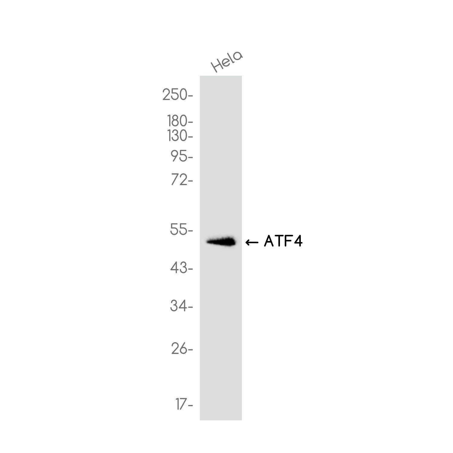 Anti-ATF4 Rabbit Monoclonal Antibody