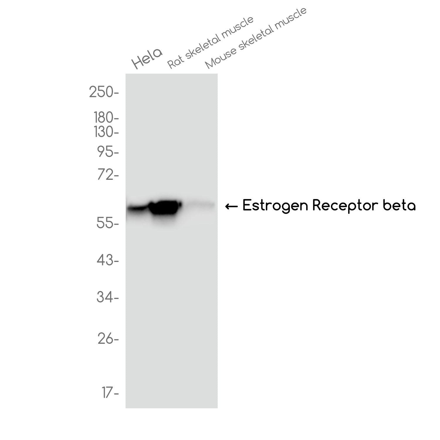 Anti-Estrogen Receptor beta Rabbit Monoclonal Antibody