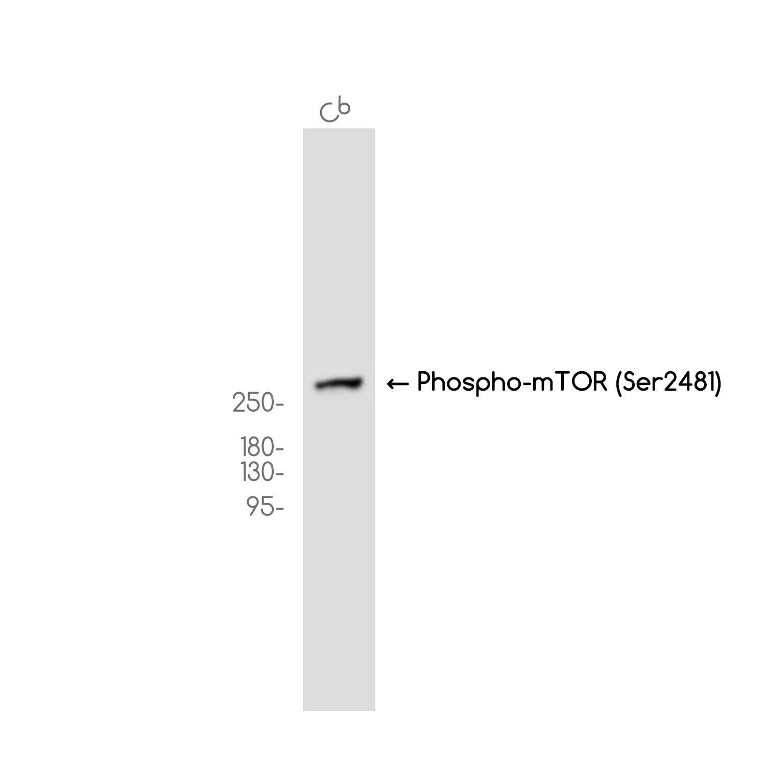 Anti-Phospho-mTOR (Ser2481) Rabbit Monoclonal Antibody