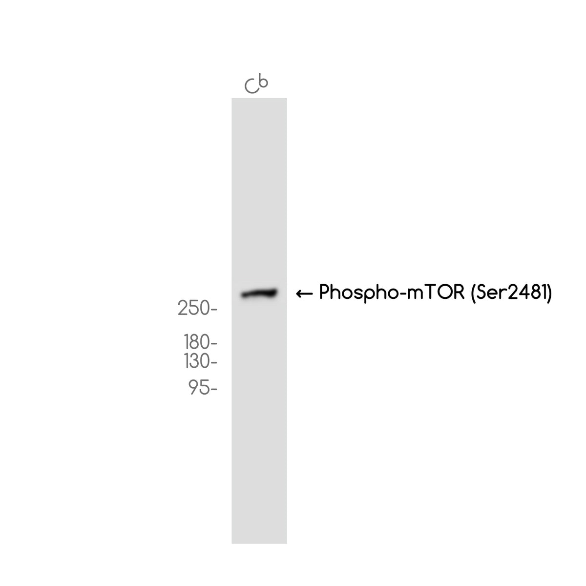 Anti-Phospho-mTOR (Ser2481) Rabbit Monoclonal Antibody