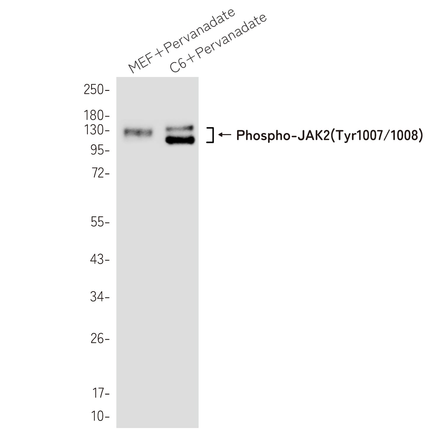 Anti-Phospho-JAK2 (Tyr1007/1008) Rabbit Monoclonal Antibody