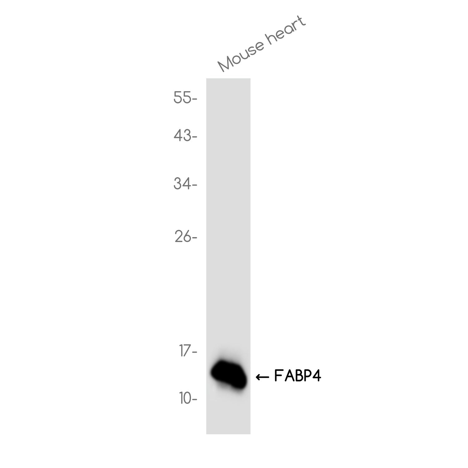 Anti-FABP4 Rabbit Monoclonal Antibody