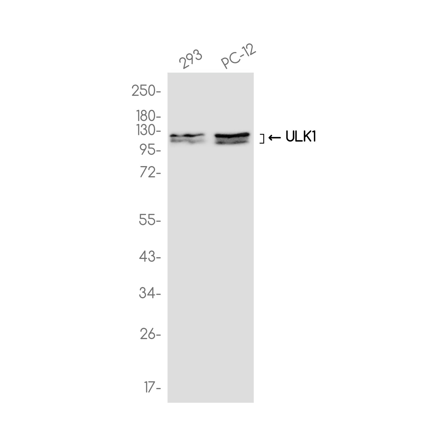 Anti-ULK1 Rabbit Monoclonal Antibody