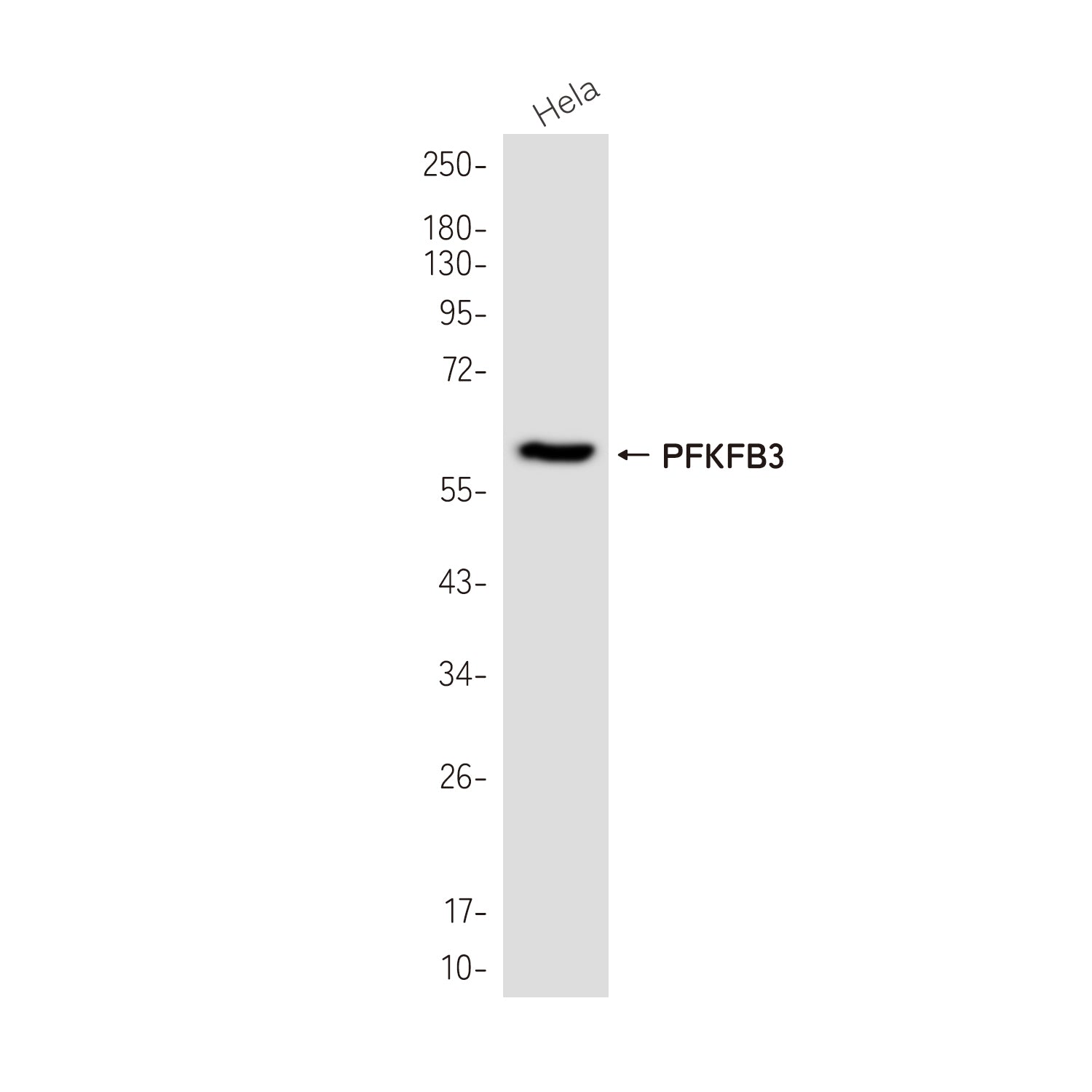 Anti-PFKFB3 Rabbit Monoclonal Antibody