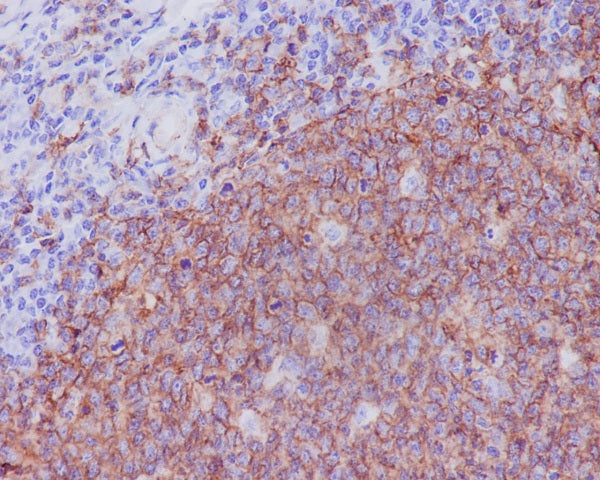 Anti-CD20 Rabbit Monoclonal Antibody