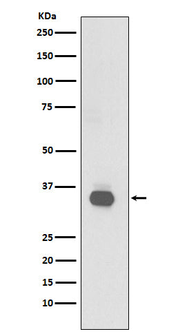 Anti-CD20 Rabbit Monoclonal Antibody