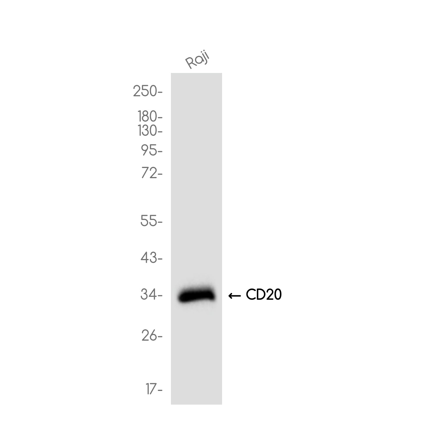 Anti-CD20 Rabbit Monoclonal Antibody