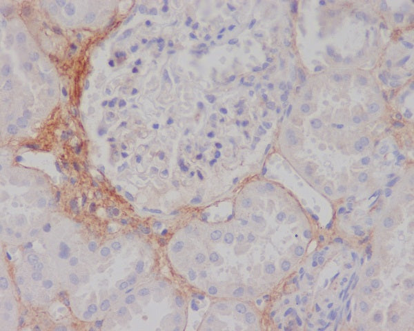 Anti-TGFBI Rabbit Monoclonal Antibody