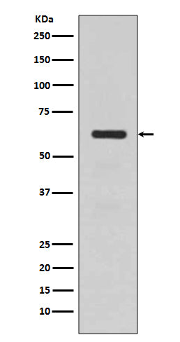 Anti-TGFBI Rabbit Monoclonal Antibody