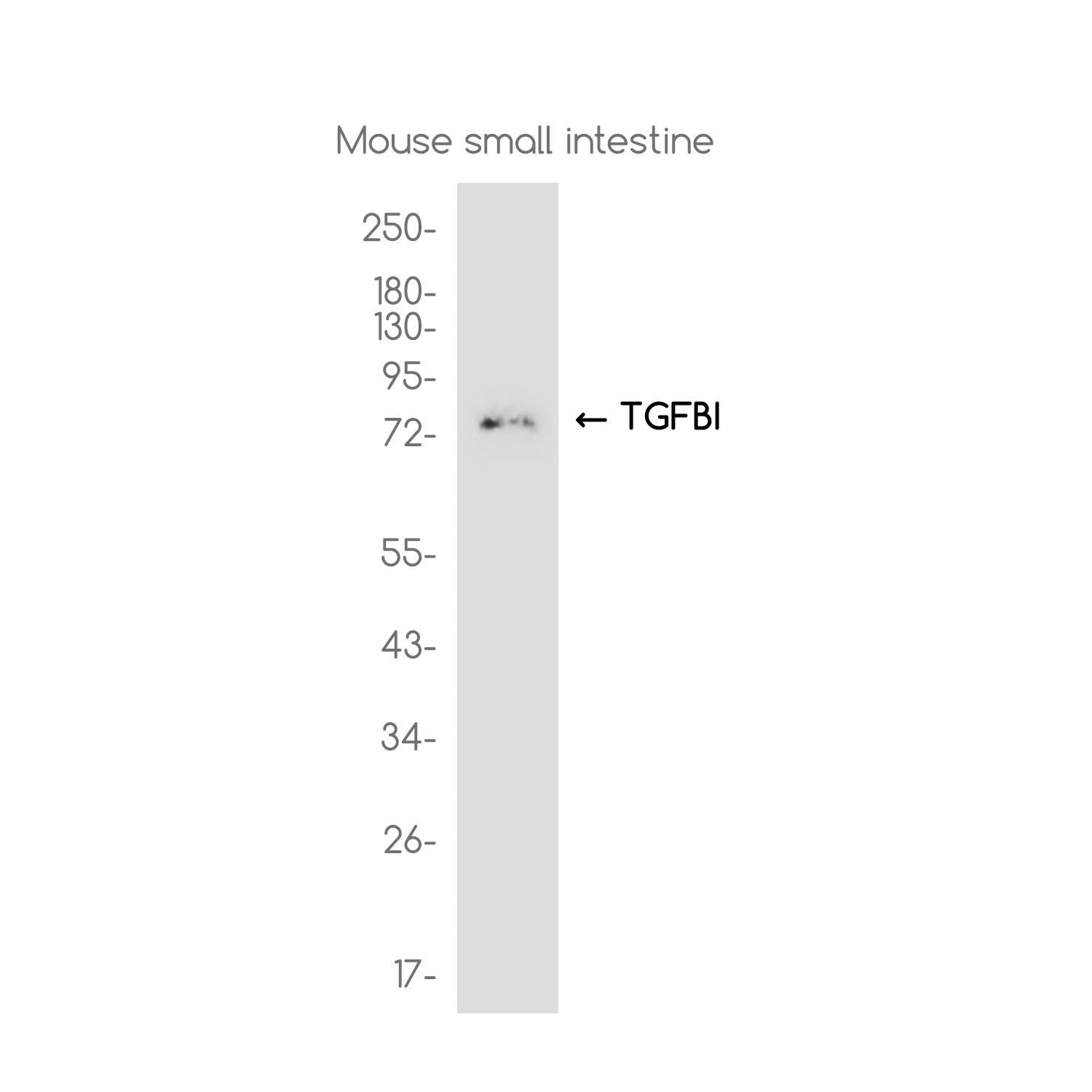 Anti-TGFBI Rabbit Monoclonal Antibody