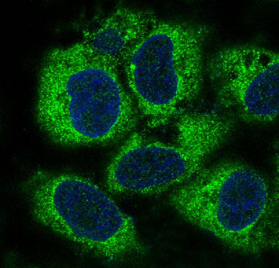 Anti-RKIP Rabbit Monoclonal Antibody