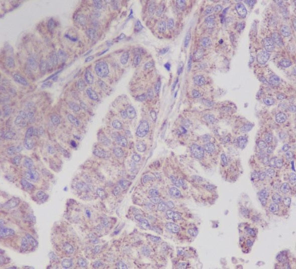 Anti-RKIP Rabbit Monoclonal Antibody