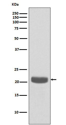Anti-RKIP Rabbit Monoclonal Antibody