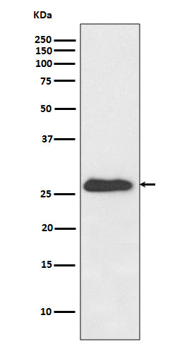 Anti-NQO2 Rabbit Monoclonal Antibody