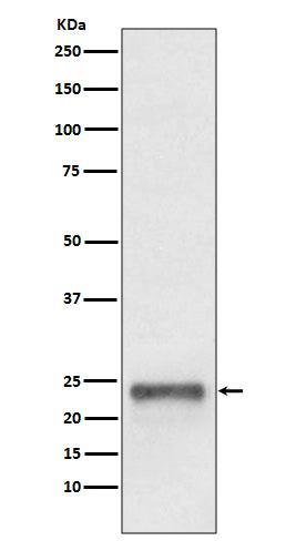 Anti-Ubiquitin D Rabbit Monoclonal Antibody