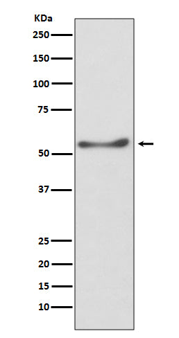 Anti-ATP5F1A Rabbit Monoclonal Antibody