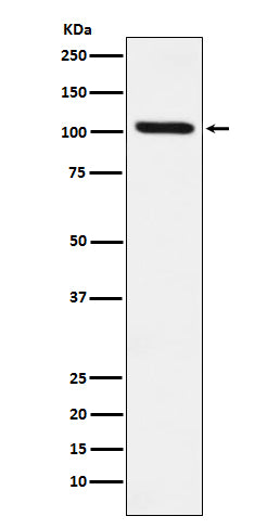 Anti-DDX58 Rabbit Monoclonal Antibody