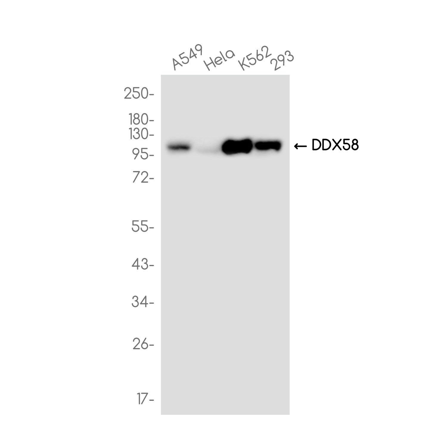 Anti-DDX58 Rabbit Monoclonal Antibody
