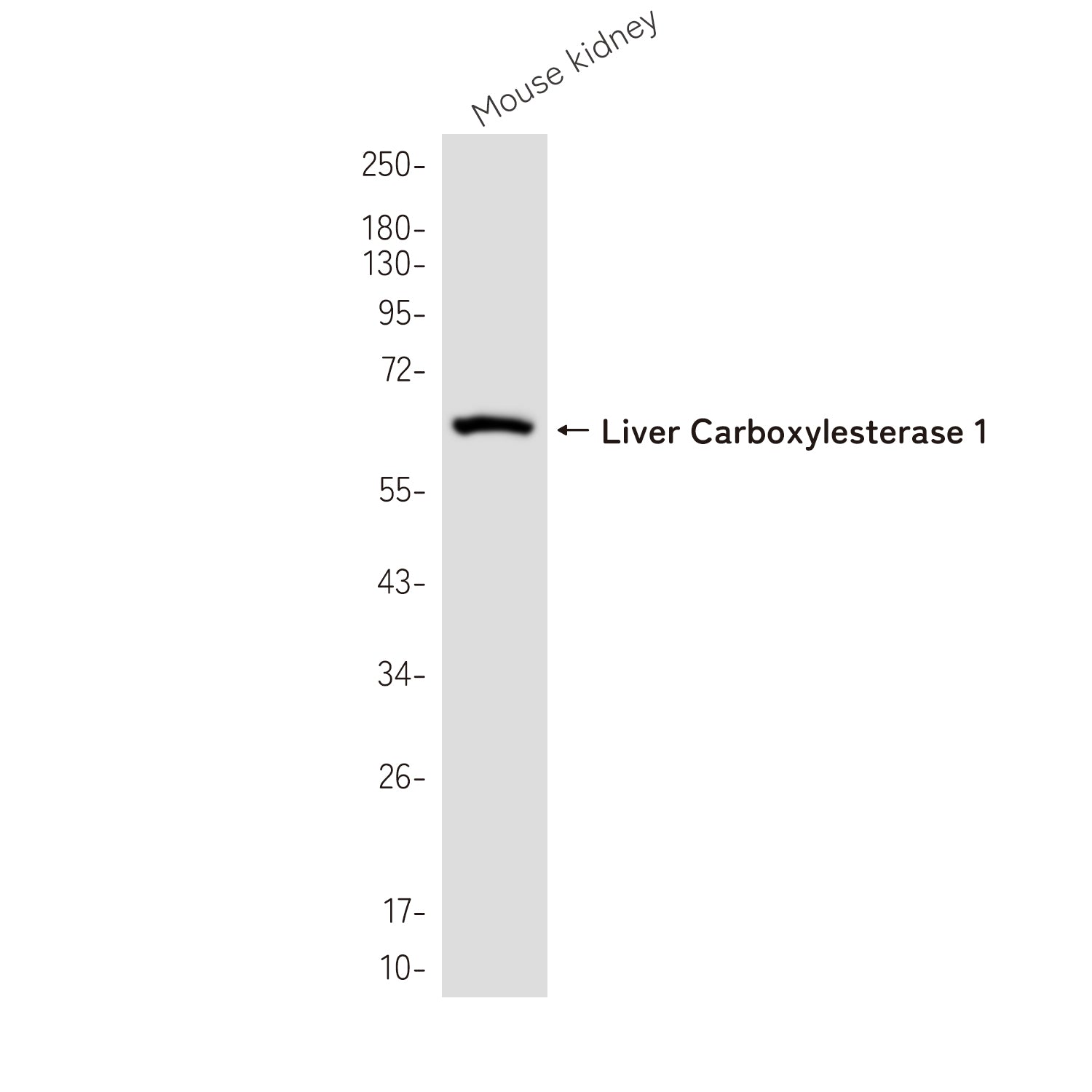 Anti-Liver Carboxylesterase 1 Rabbit Monoclonal Antibody