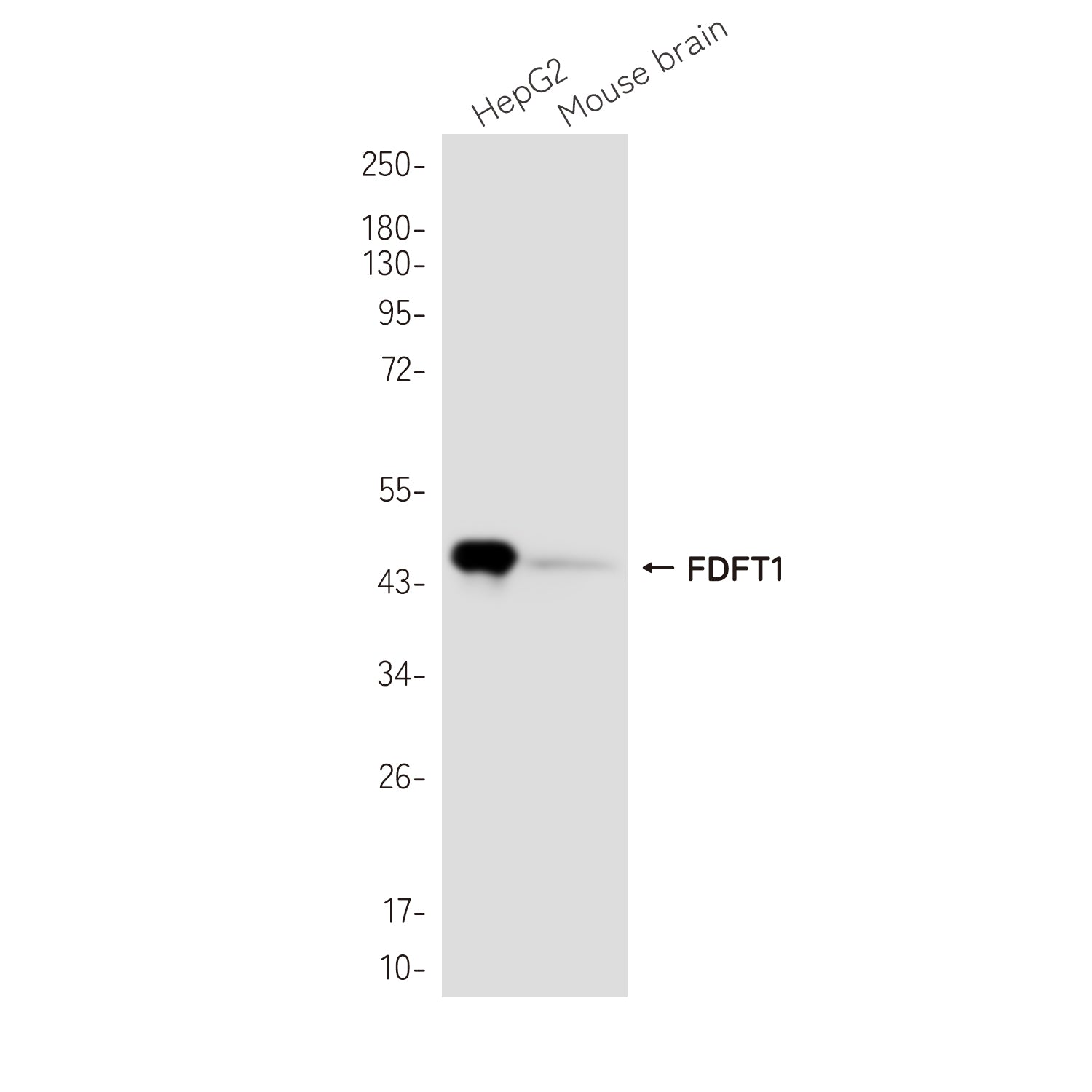 Anti-FDFT1 Rabbit Monoclonal Antibody