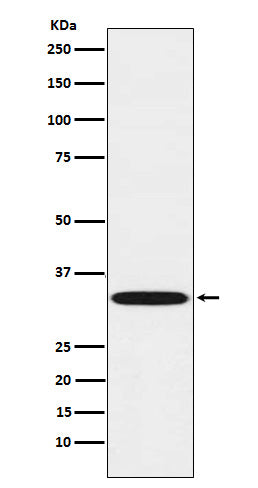 Anti-TREX1 Rabbit Monoclonal Antibody