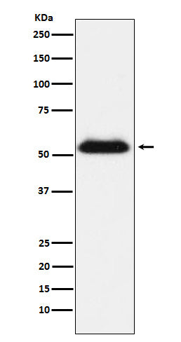 Anti-Transmembrane Protease Serine 2 Rabbit Monoclonal Antibody