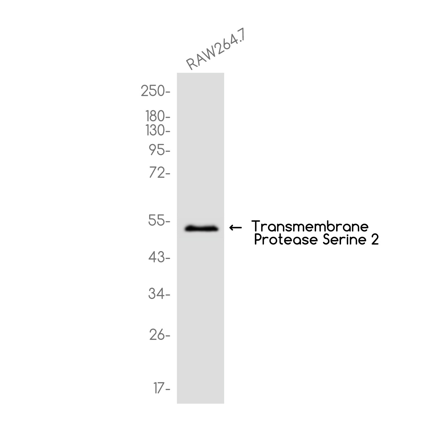 Anti-Transmembrane Protease Serine 2 Rabbit Monoclonal Antibody