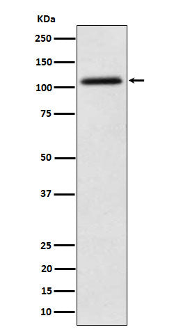 Anti-NAT10 Rabbit Monoclonal Antibody
