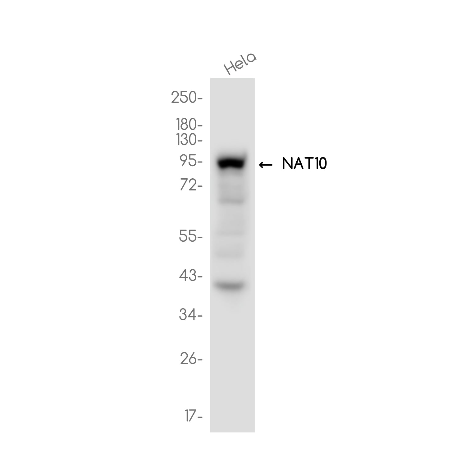 Anti-NAT10 Rabbit Monoclonal Antibody