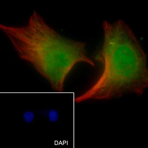 Anti-CDK1/CDC2 Rabbit Monoclonal Antibody