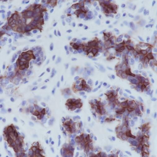 Anti-Keratin 5 Rabbit Monoclonal Antibody