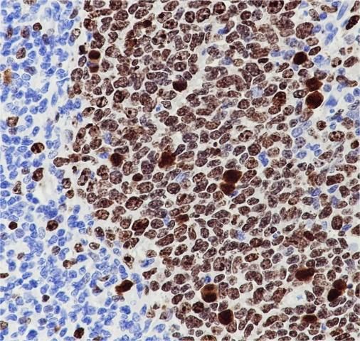 Anti-Ki67 Rabbit Monoclonal Antibody