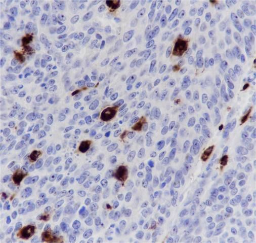 Anti-CD68 Rabbit Monoclonal Antibody