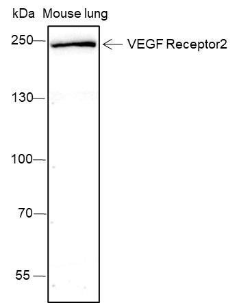 Anti-VEGF Receptor2 Rabbit Monoclonal Antibody