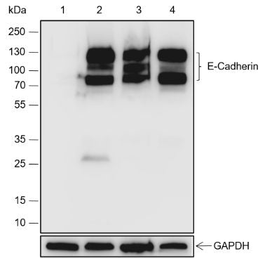 Anti-E Cadherin Rabbit Monoclonal Antibody