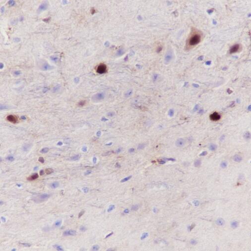 Anti-S100 beta Rabbit Monoclonal Antibody